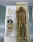 南充古尸是不是真的，古尸为什么要烧掉有什么猫腻吗？